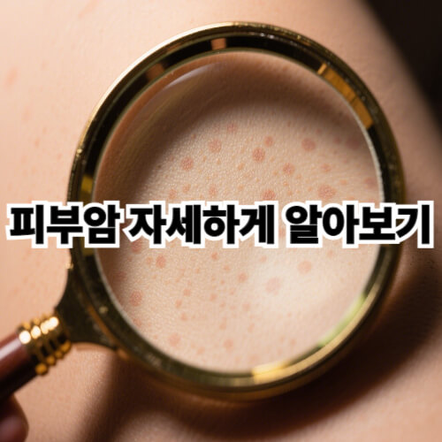 피부암 초기증상, 놓치면 후회하는 7가지 신호와 예방법