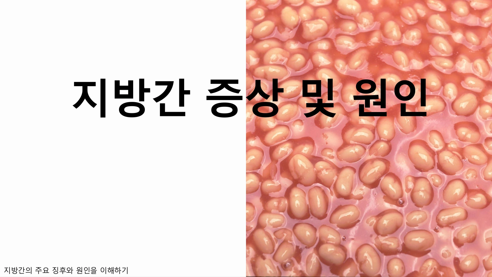 지방간 증상·원인 총정리! 방치하면 생기는 무서운 결과